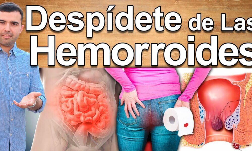 Adiós A Las Hemorroides Soluciones Naturales 100 Efectivas Salud Chicas