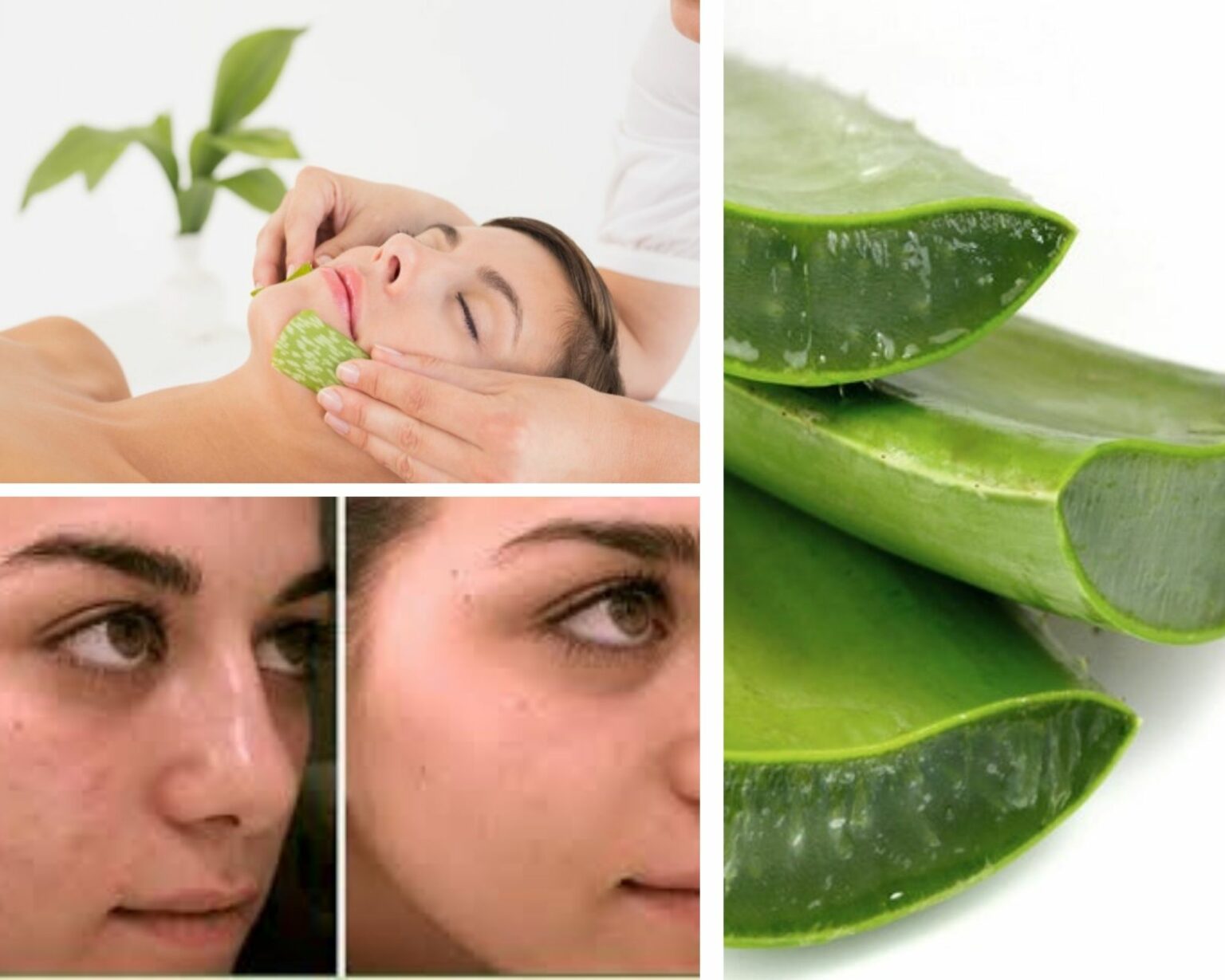 Mascarilla De Aloe Vera Para Piel Grasa Hidrata Y Limpia 6371